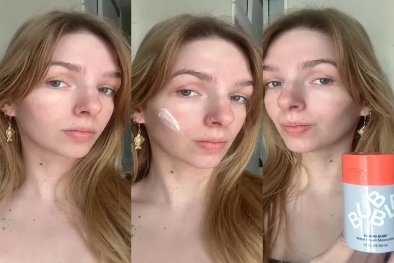 Acne Gel